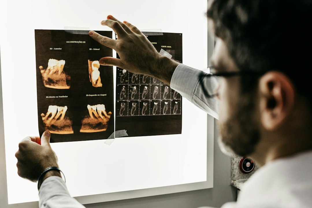 Evaluación odontológica para implantes dentales