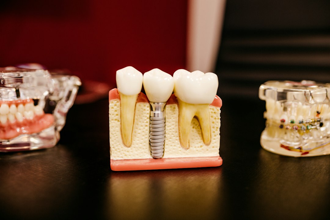 Modelo dental para rehabilitación y prótesis